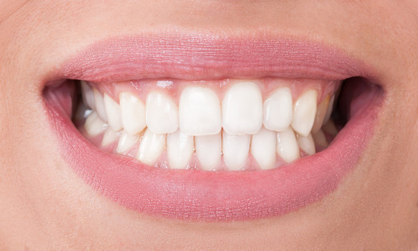 A Brighter Smile Awaits: Prodentim’s Secrets to Teeth Whitening